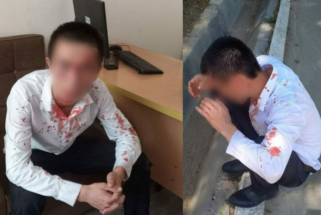 Алламжонов: Те, кто избил учителя, будут строго наказаны