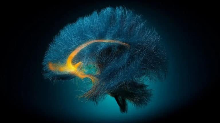 Depressiyani oldindan aniqlovchi miya implanti ishlab chiqildi