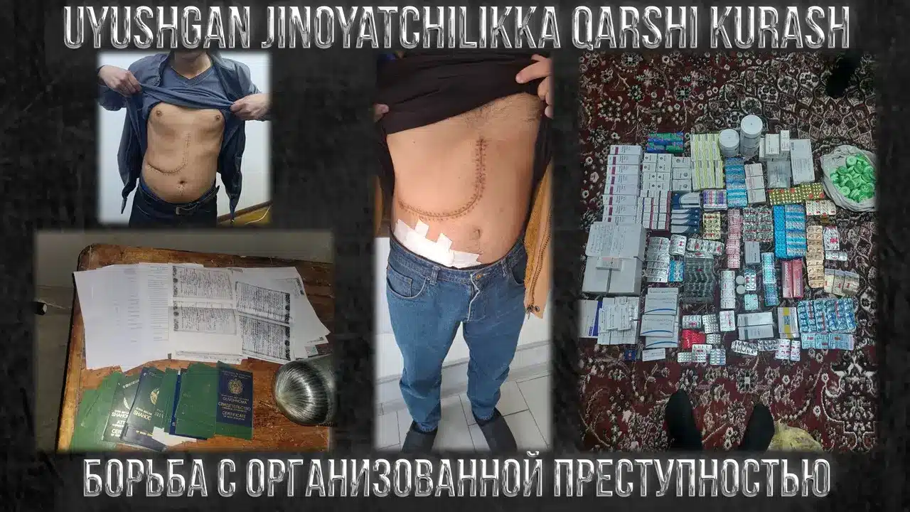 торговля органами
