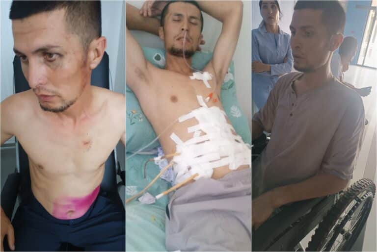 Profilaktika inspektori tomonidan fuqaro jarohatlangani yuzasidan jinoyat ishi qo‘zg‘atildi
