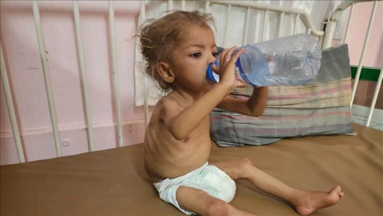 UN Warns of Nearly 95,000 Child Malnutrition Cases in Gaza in 2025