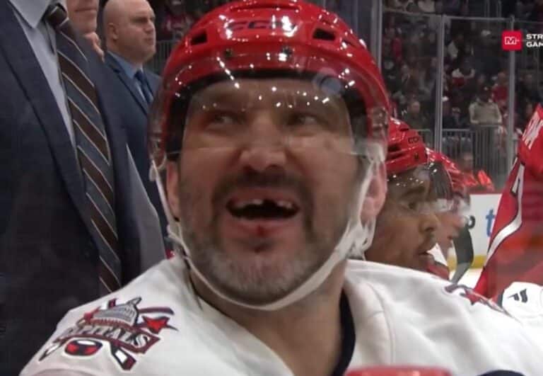 Овечкину выбили зуб в матче с Чикаго