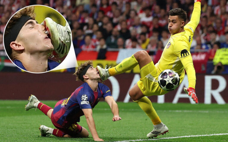 Lopez Suffers Facial Injury as Barcelona Exit Champions League