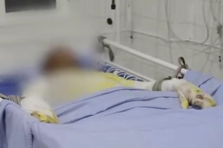 Chirchiqda selfi fojiasi: vagon ustiga chiqqan 17 yoshli o‘smirni tok urdi