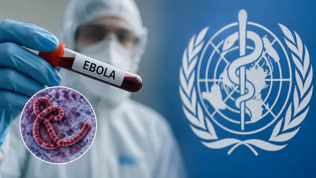 Ebola virusi O‘zbekiston uchun qanchalik xavfli