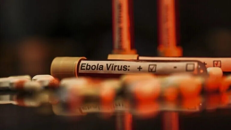 Kongoda Ebola bilan kasallanganlar soni 3,7 mingdan oshdi